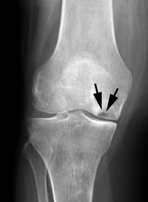 knee x-ray 5